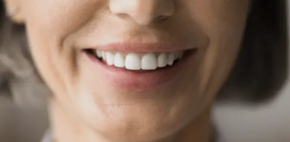 Teeth Straightening Adelaide’ What to Expect During Your Teeth Straightening Journey in Adelaide
