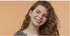 Dental Braces Adelaide’ Metal vs. Ceramic Braces for Your Lifestyle