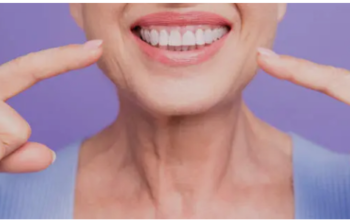 dental implants Adelaide